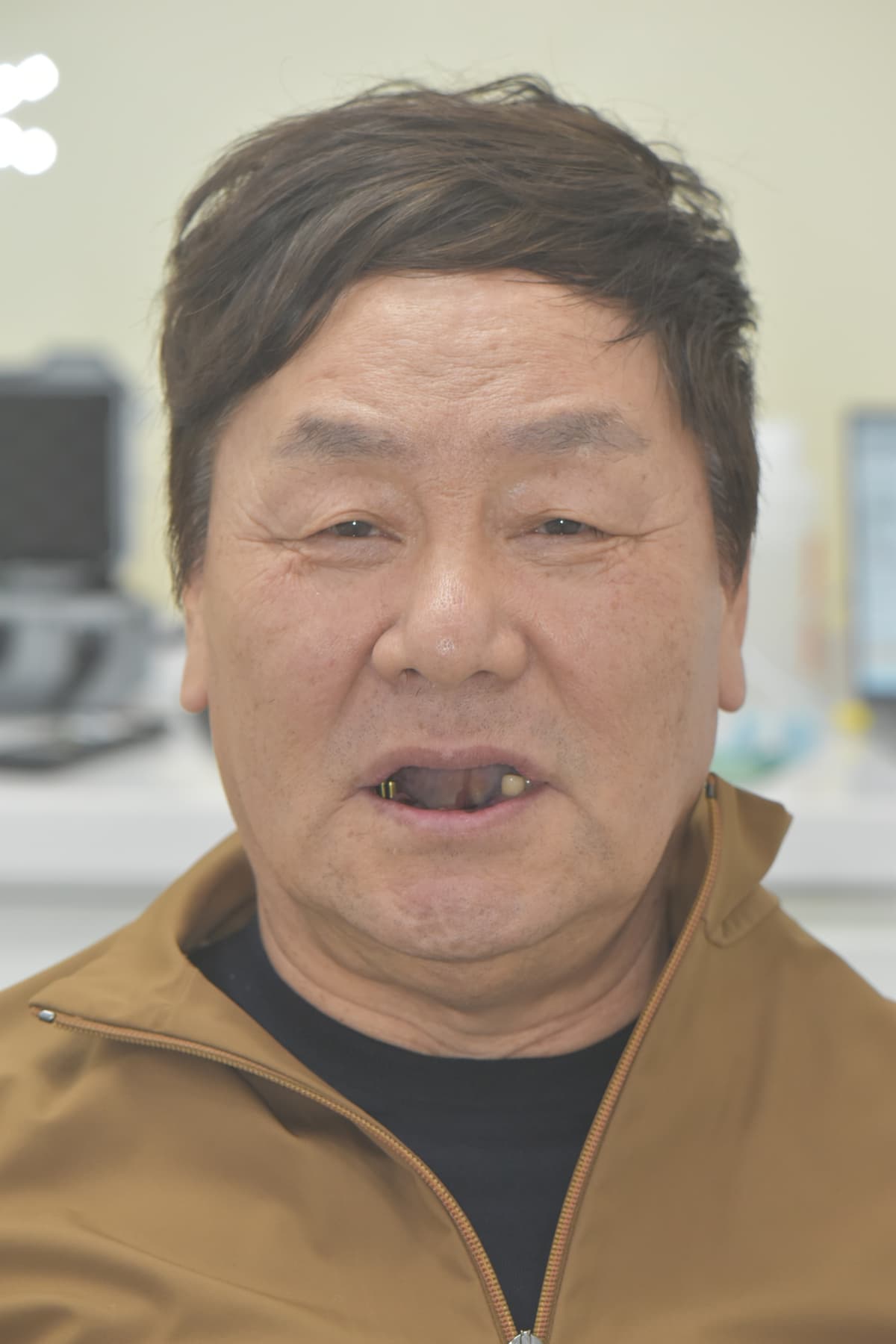 Bir kunlik vaqtincha tishdan oldin